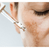 Skin Hyperpigmentation | 3AM